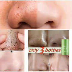 Green Tea Deep Clean Stick Mask – Acne & Blackhead Remover