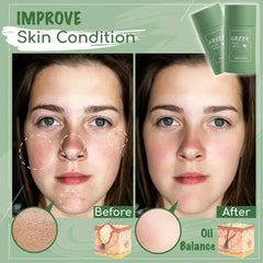 Green Tea Deep Clean Stick Mask – Acne & Blackhead Remover