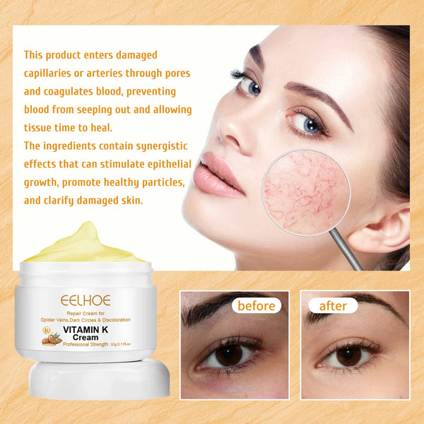 EELHOE Vitamin K Vein Care Cream