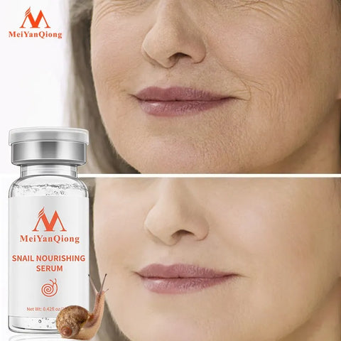 MeiYanQiong Snail Essence Whitening Serum