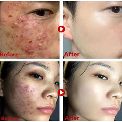 Green Tea Deep Clean Stick Mask – Acne & Blackhead Remover